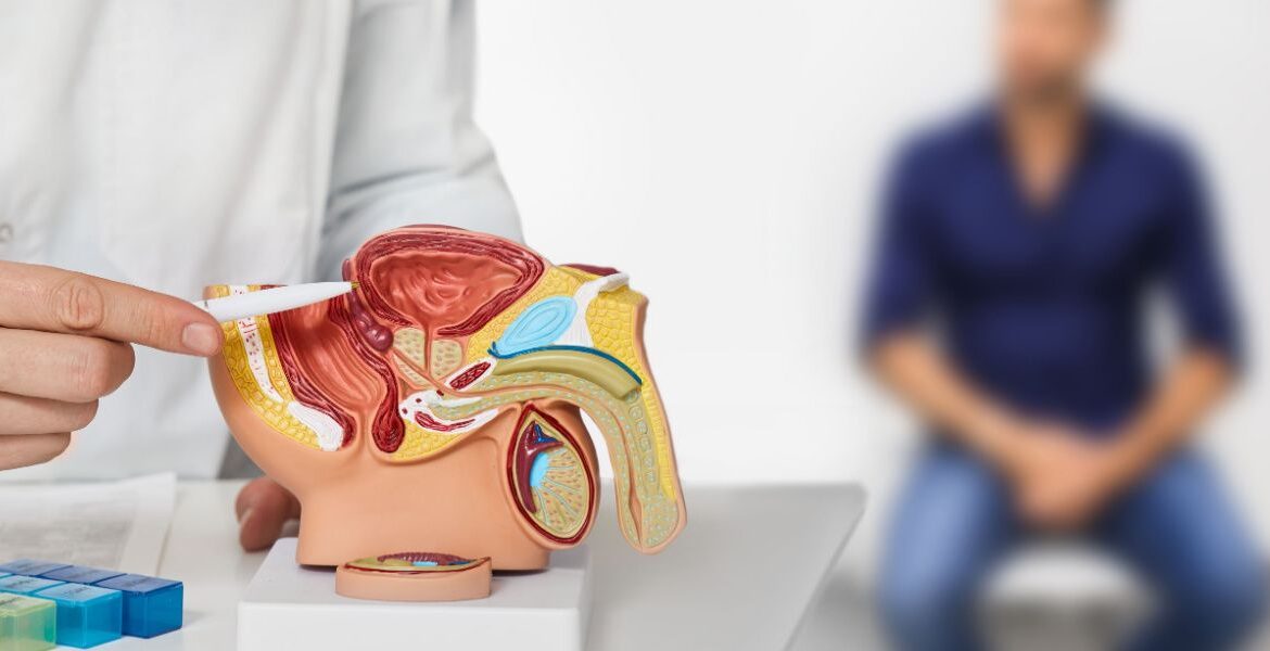 ¿Cómo se puede prevenir el cáncer de próstata?