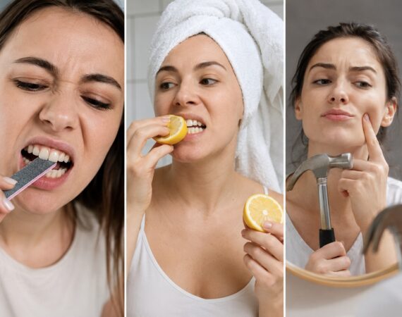 TikTok y salud dental: la peligrosa moda de hacerse daño sin saberlo